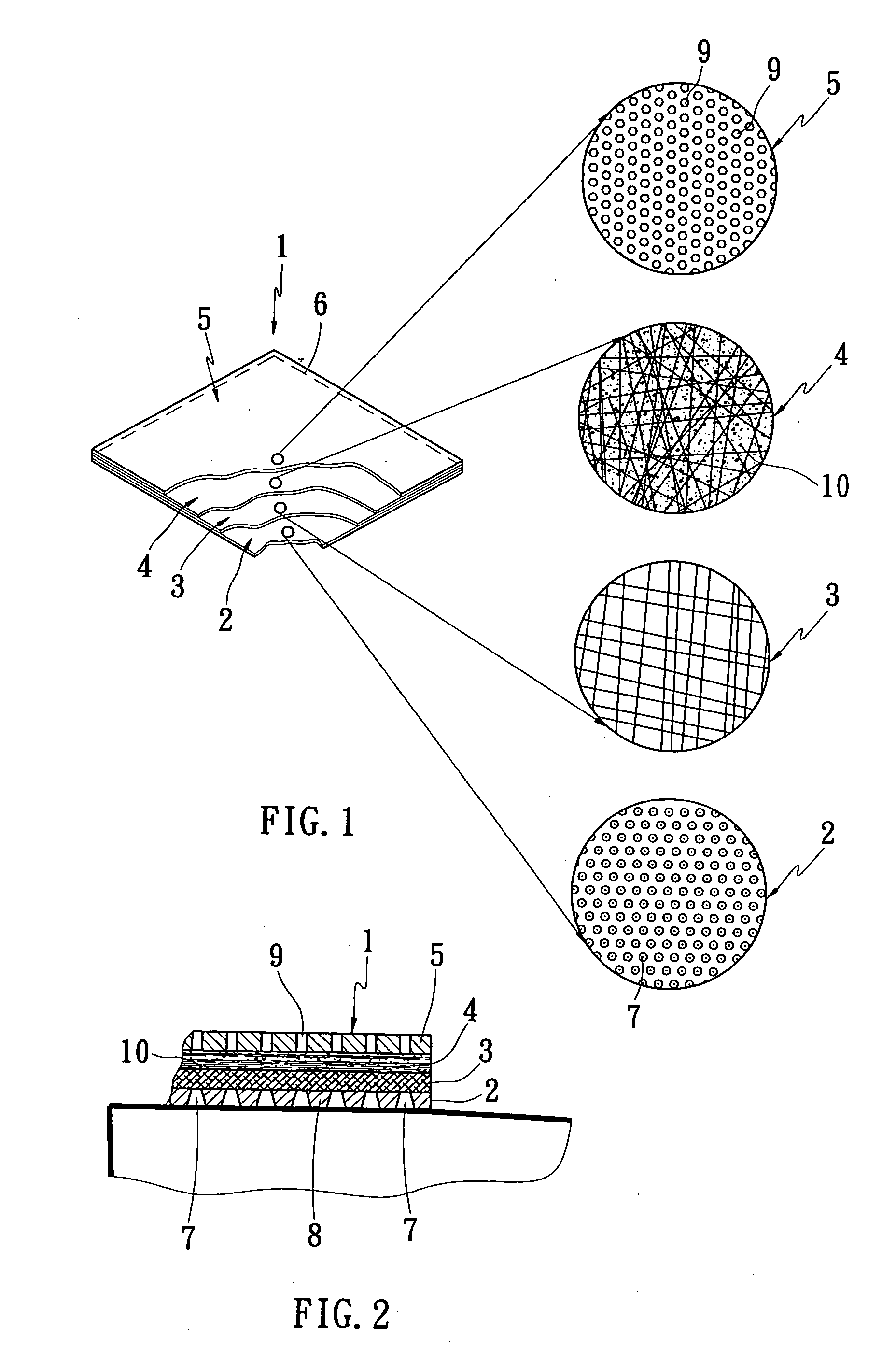 Absorbent sac wound dressing