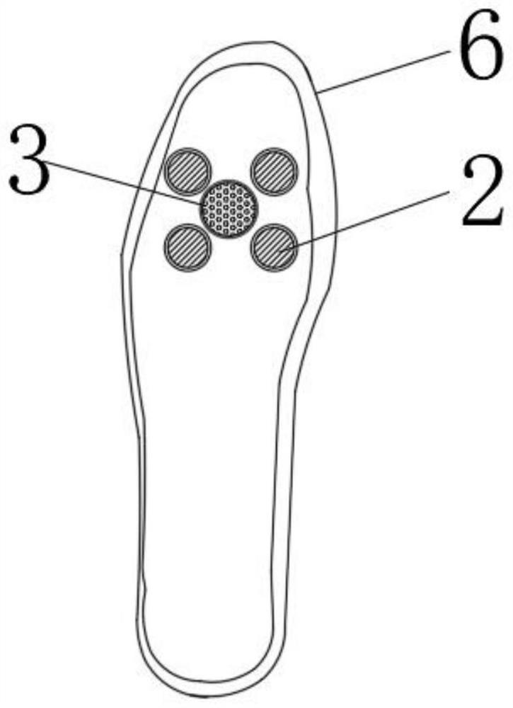 3D printing diabetic foot insole capable of continuously dosing or applying electrical stimulation