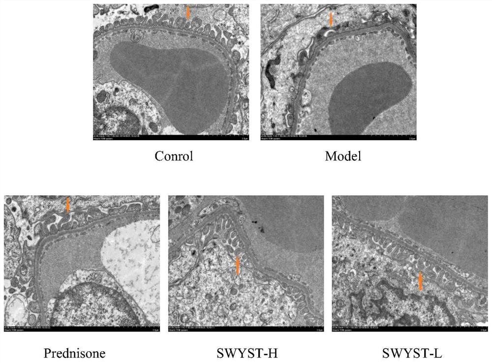 Application of traditional Chinese medicine composition in preparation of medicine for treating podocytosis