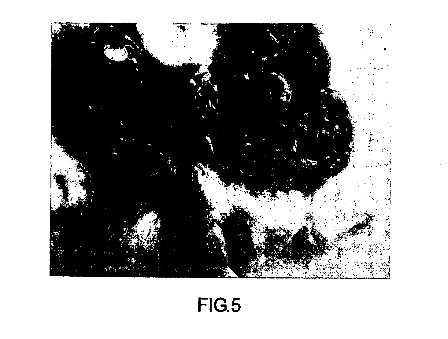 Modified starch material of biocompatible hemostasis