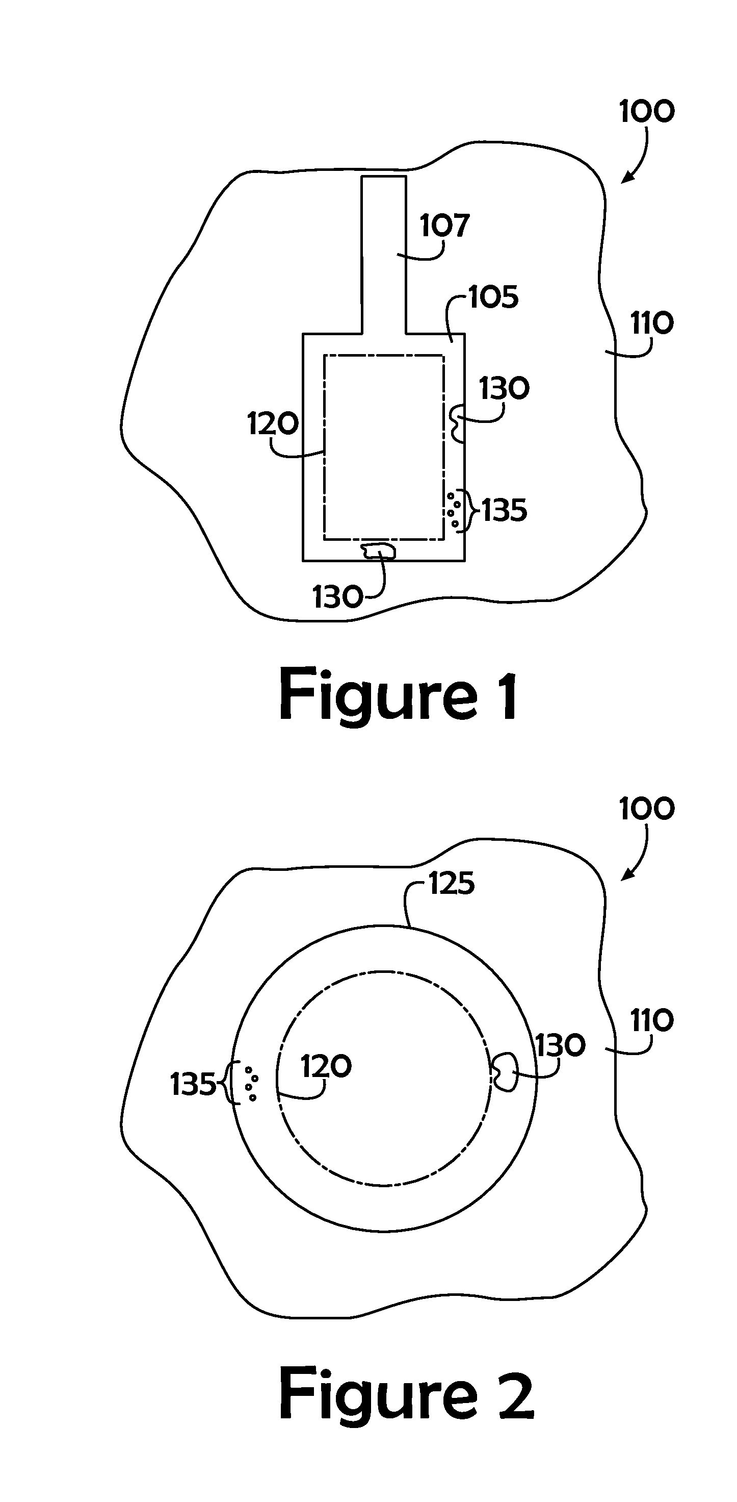 Defective conductive surface pad repair for microelectronic circuit cards