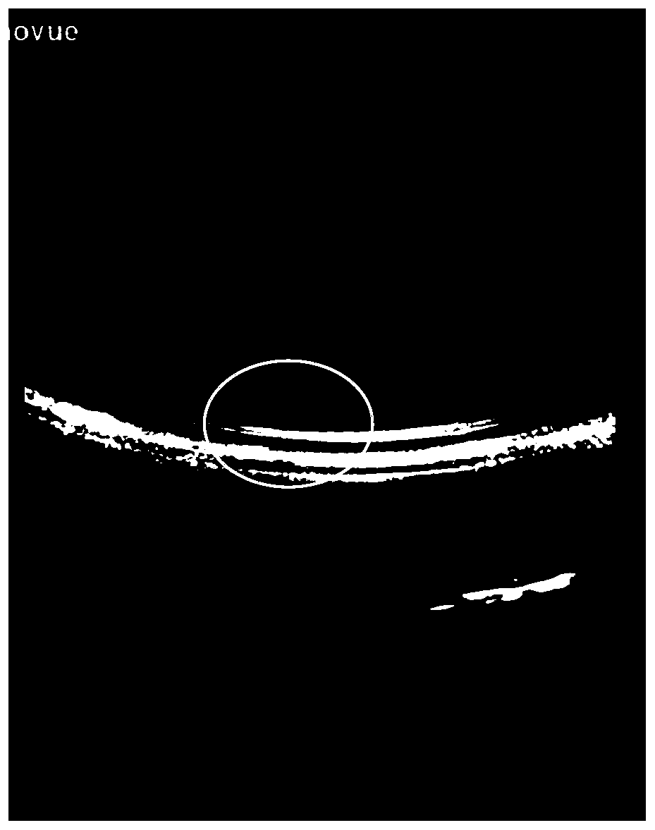 Ultrasonic-magnetic resonance imaging bimodal contrast agent and preparation method and application thereof