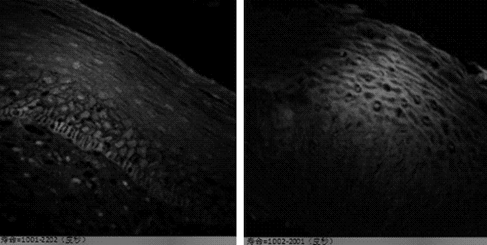 A Device Combining Autofluorescence Lifetime Imaging and Fluorescence Spectroscopy for Early Diagnosis of Cancer