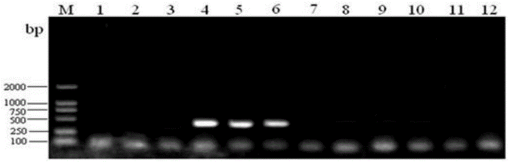 Fast qualitative and quantitative detection kit for enterococcus faecalis added to feed, detection method and application