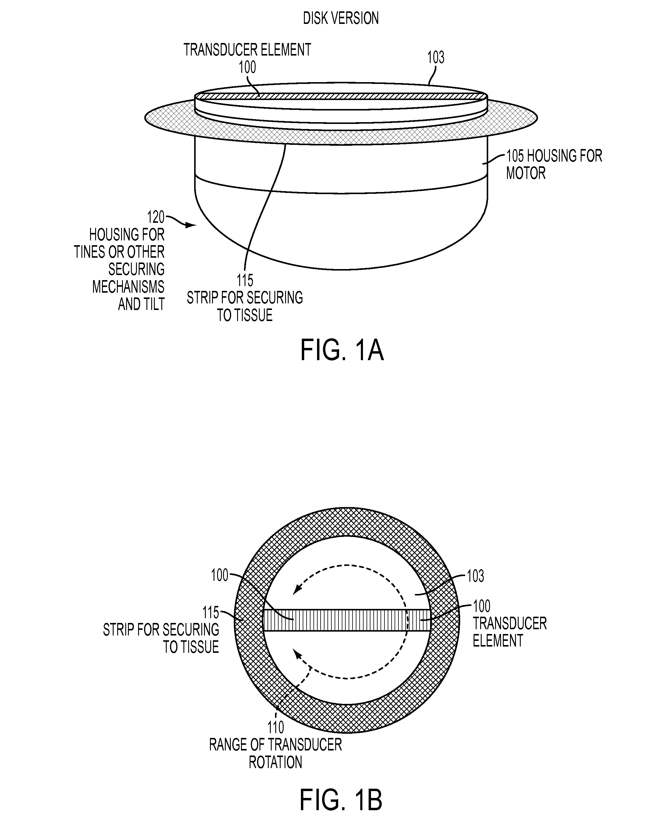 Remote ultrasound assessment and intervention system