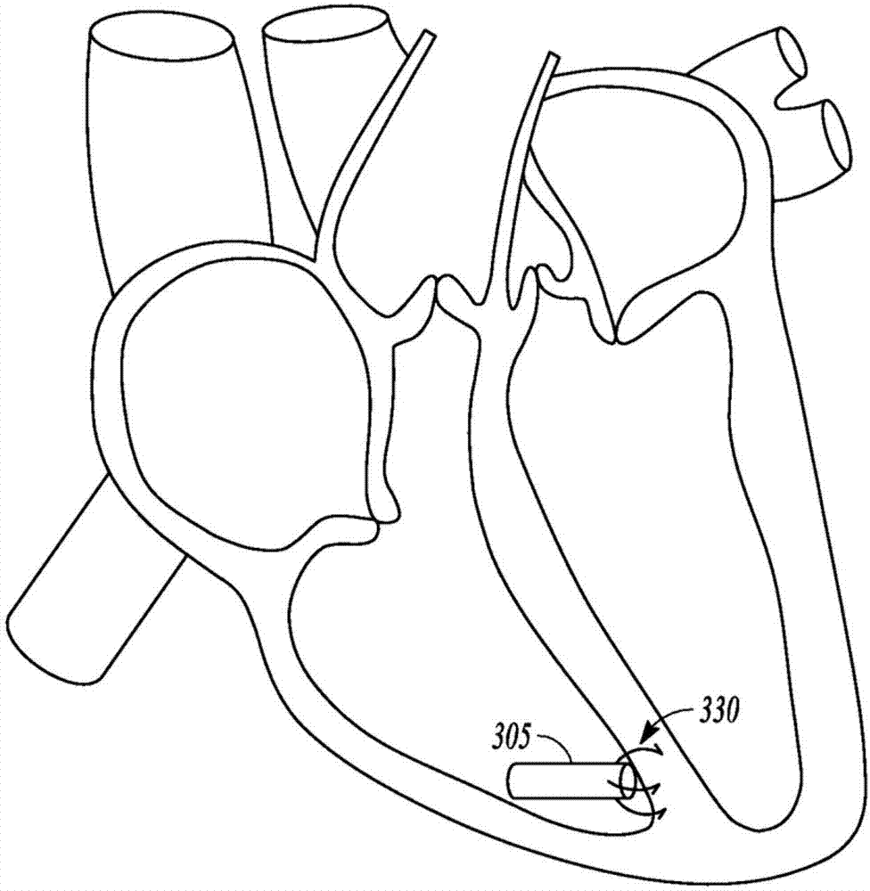 Atrial fibrillation detection