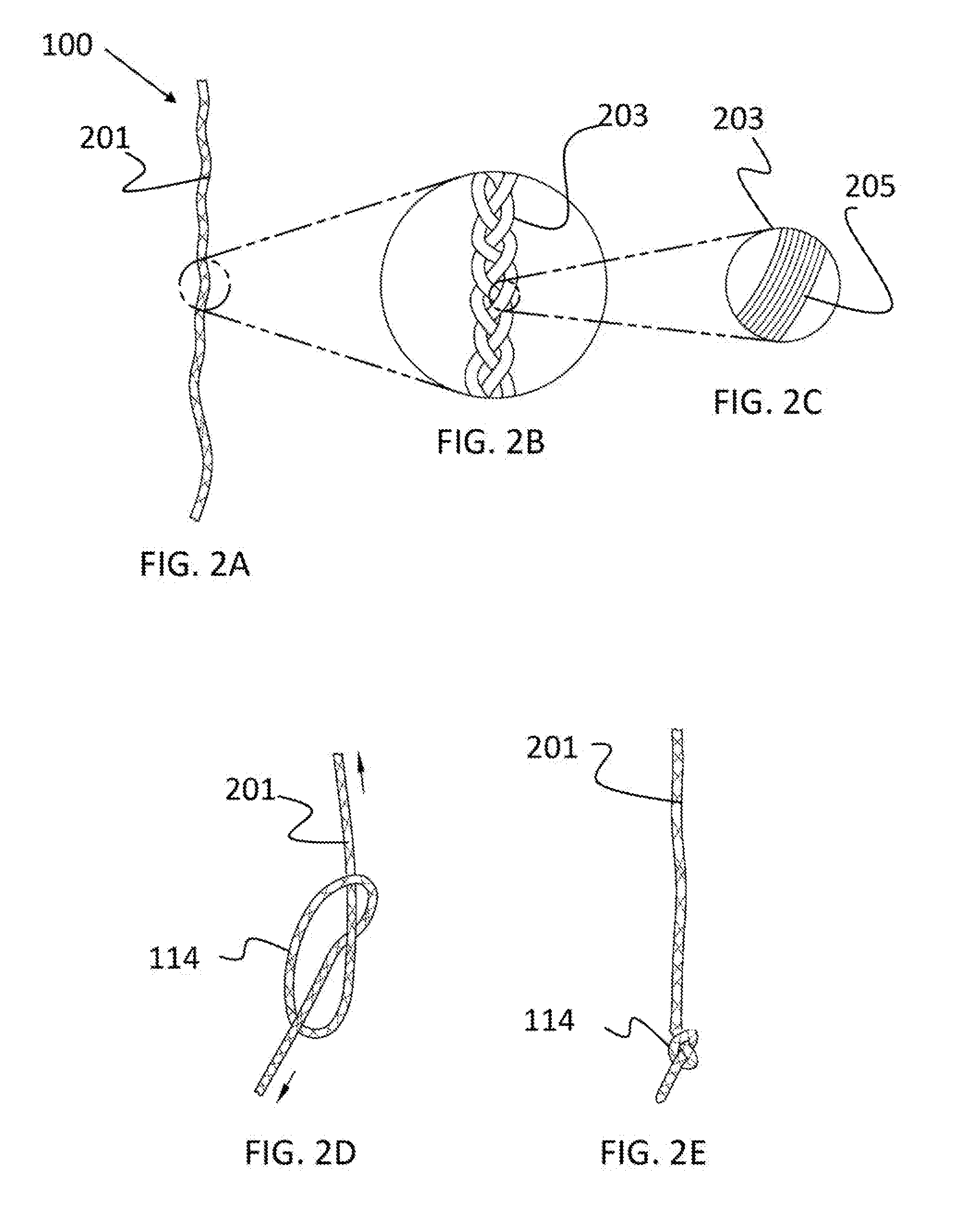 Delivery system for transcatheter detachment of a stent from the delivery device