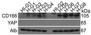 Application of CD166 as liver cancer diagnosis serum marker and kit thereof