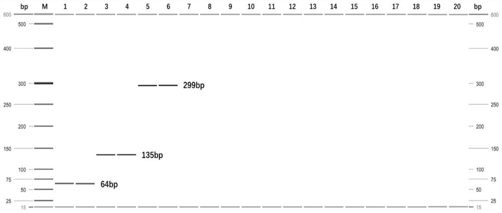 A multiple PCR detection kit for Anopheles glabra, Anopheles multicolored and Anopheles aconitum