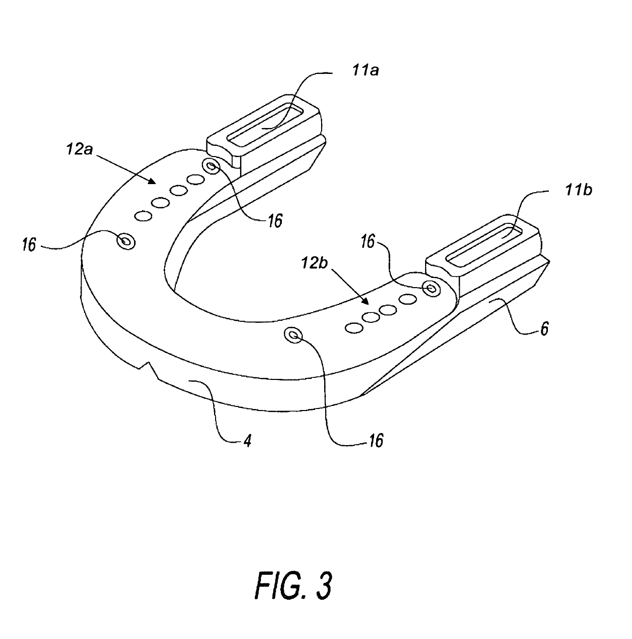 Dental appliance