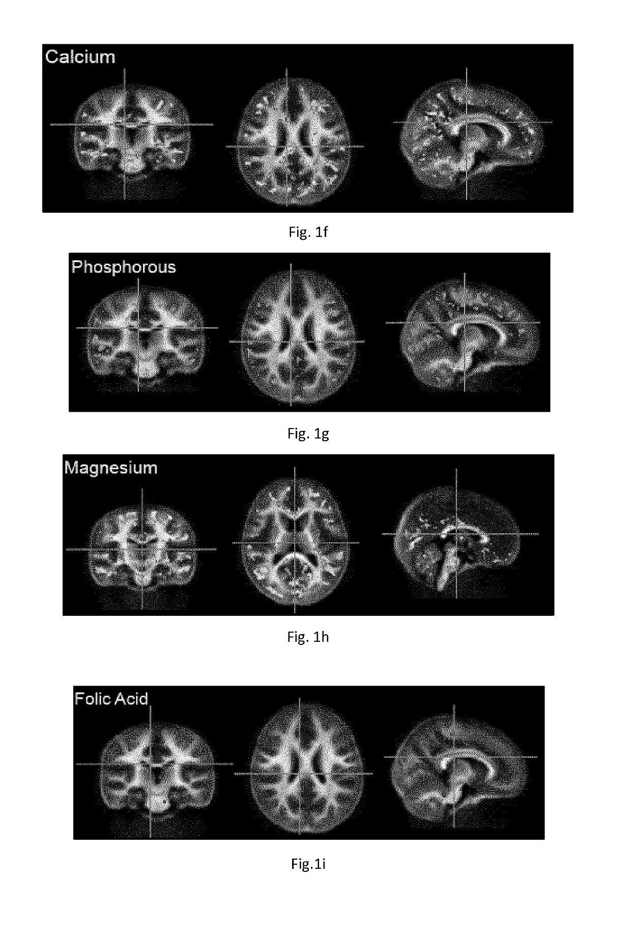 Nutritional compositions and infant formula for promoting de novo myealination