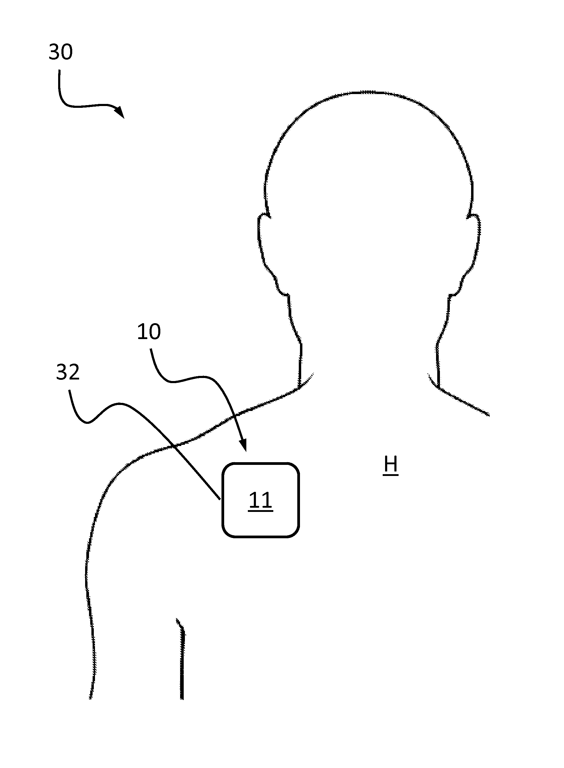 Disposable Vibratory Apparatus