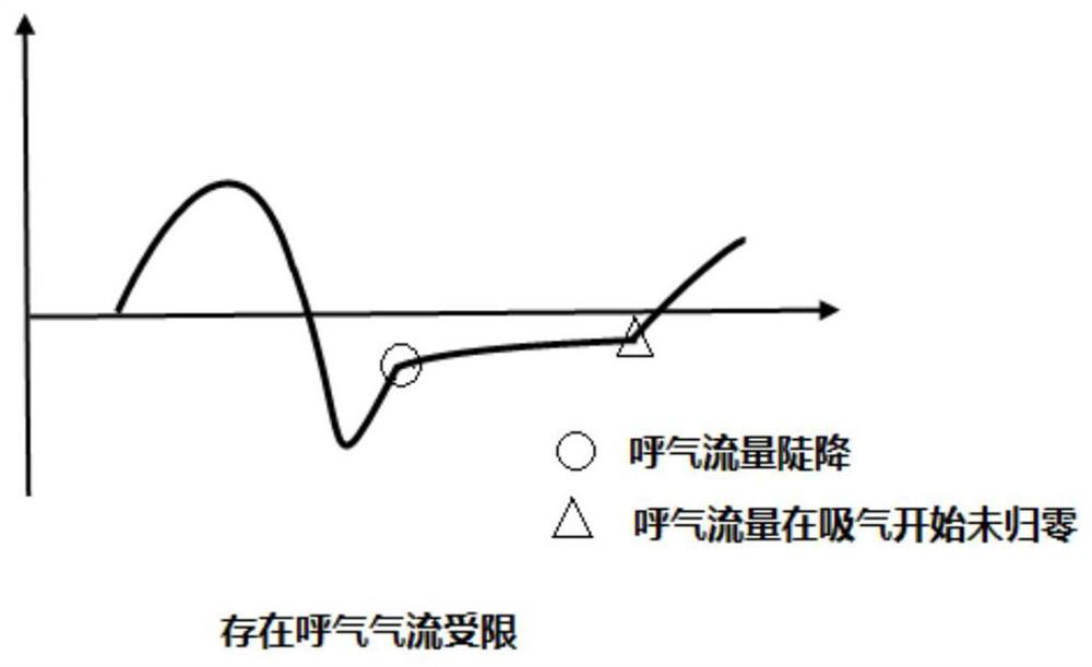 Expiratory pressure automatic titration method and system based on expiratory flow limited index