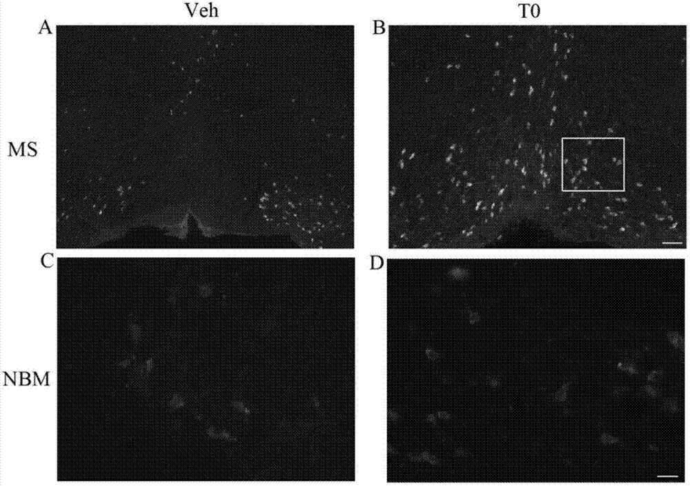 Application of liver X receptor activator in anti-nerve inflammatory reaction