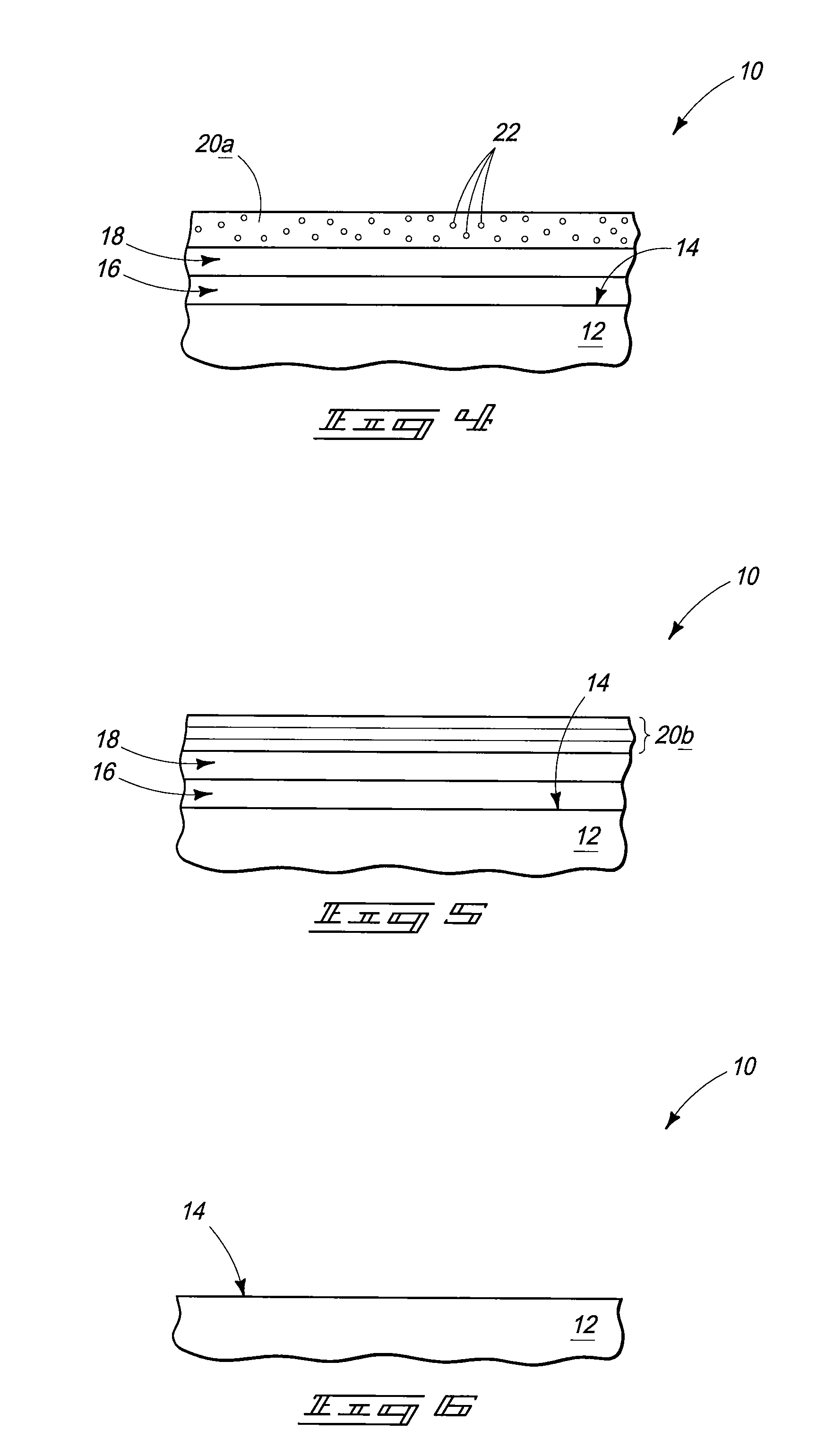 Medical implants and methods of making medical implants