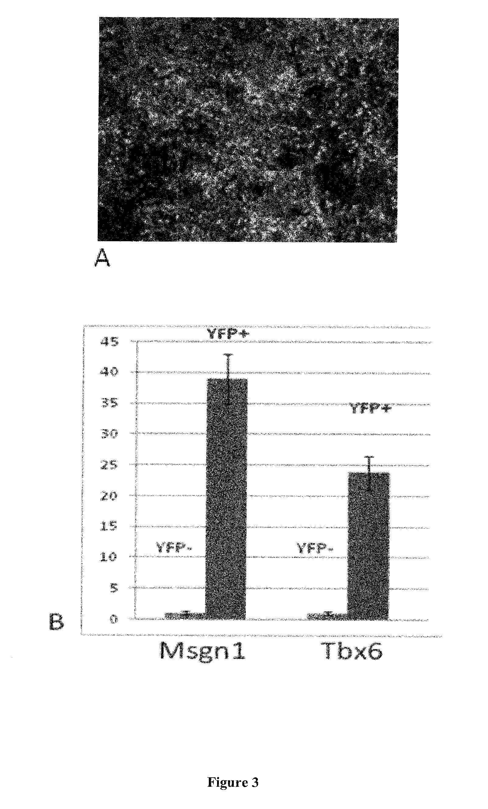 Method for preparing induced paraxial mesoderm progenitor (IPAM) cells and their use