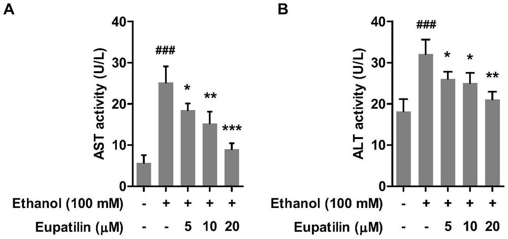 Application of euphorbitin in preparation of medicine for preventing or treating alcoholic liver diseases