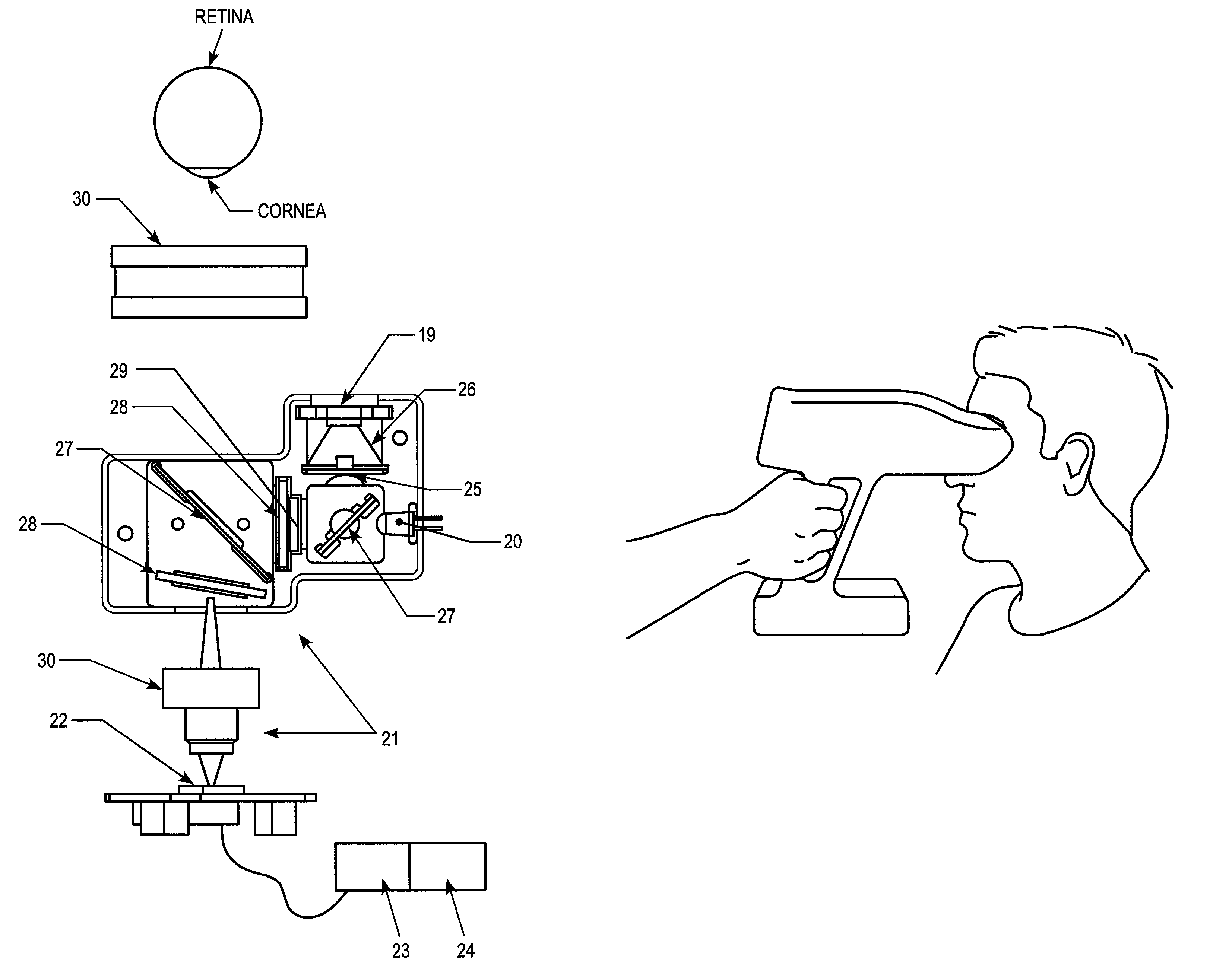 Apparatus, methods and systems for non-invasive ocular assessment of neurological function