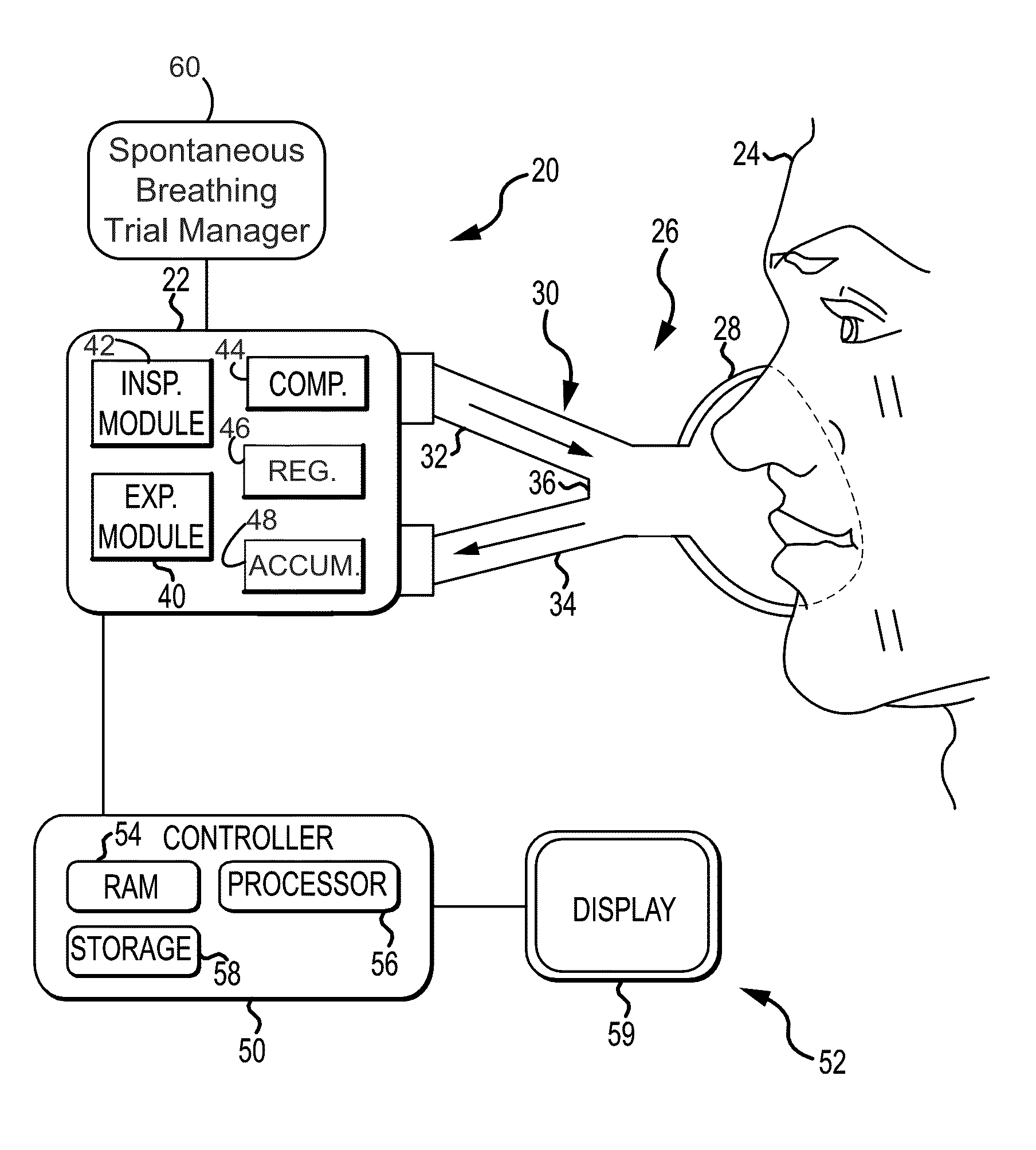 Spontaneous breathing trial manager