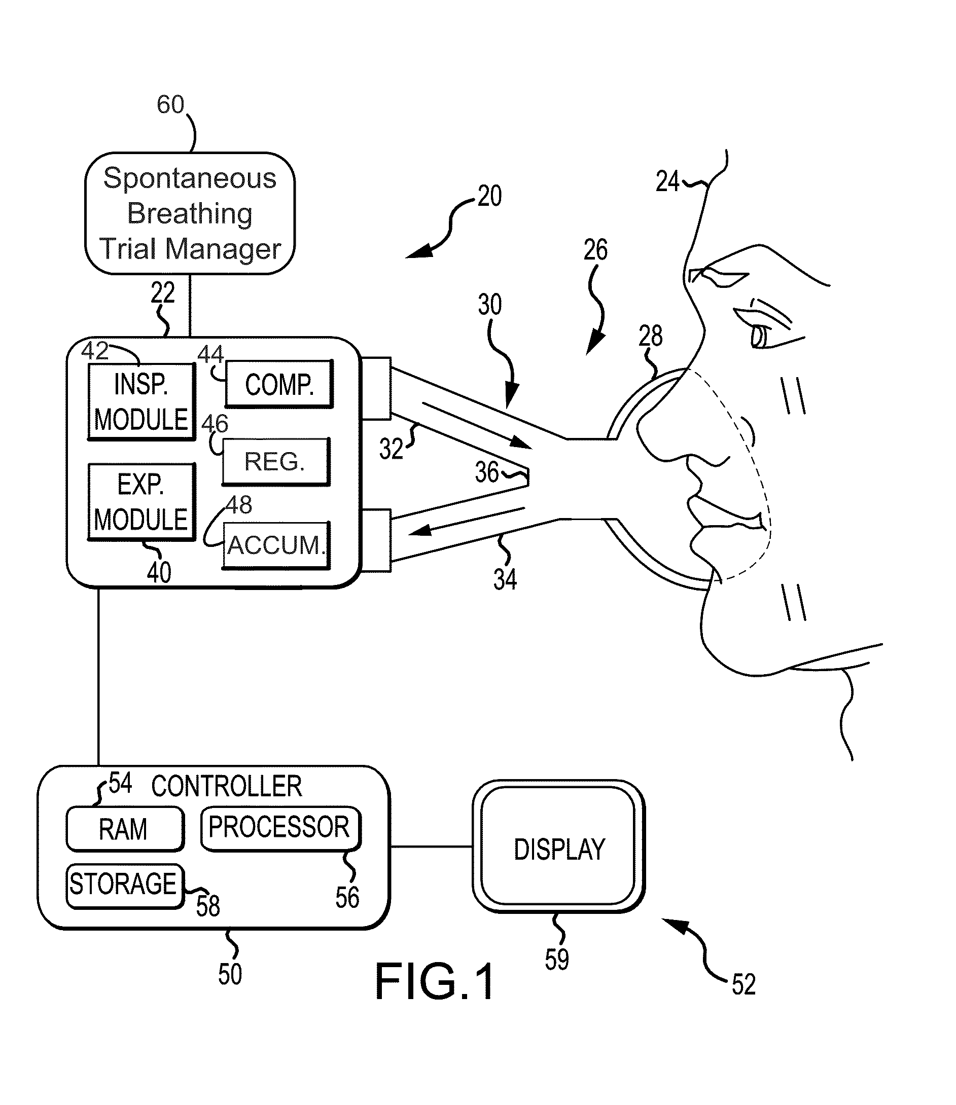 Spontaneous breathing trial manager