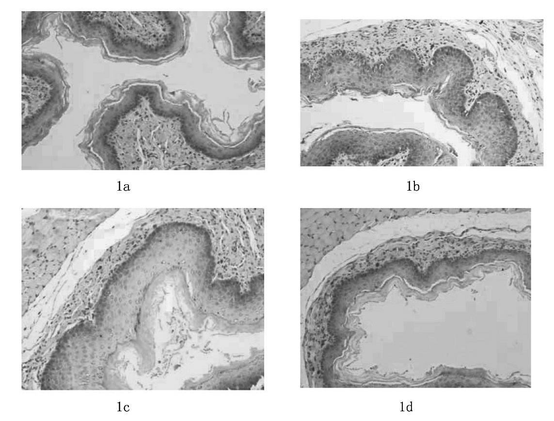 Chinese medicinal composition and preparation for treating recurrent oral ulcer and preparation method thereof