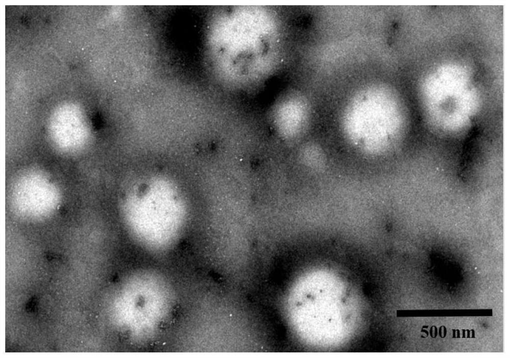 Naringin nano inhalation powder inhalation taking polylysine as carrier as well as preparation method and application of naringin nano inhalation powder inhalation