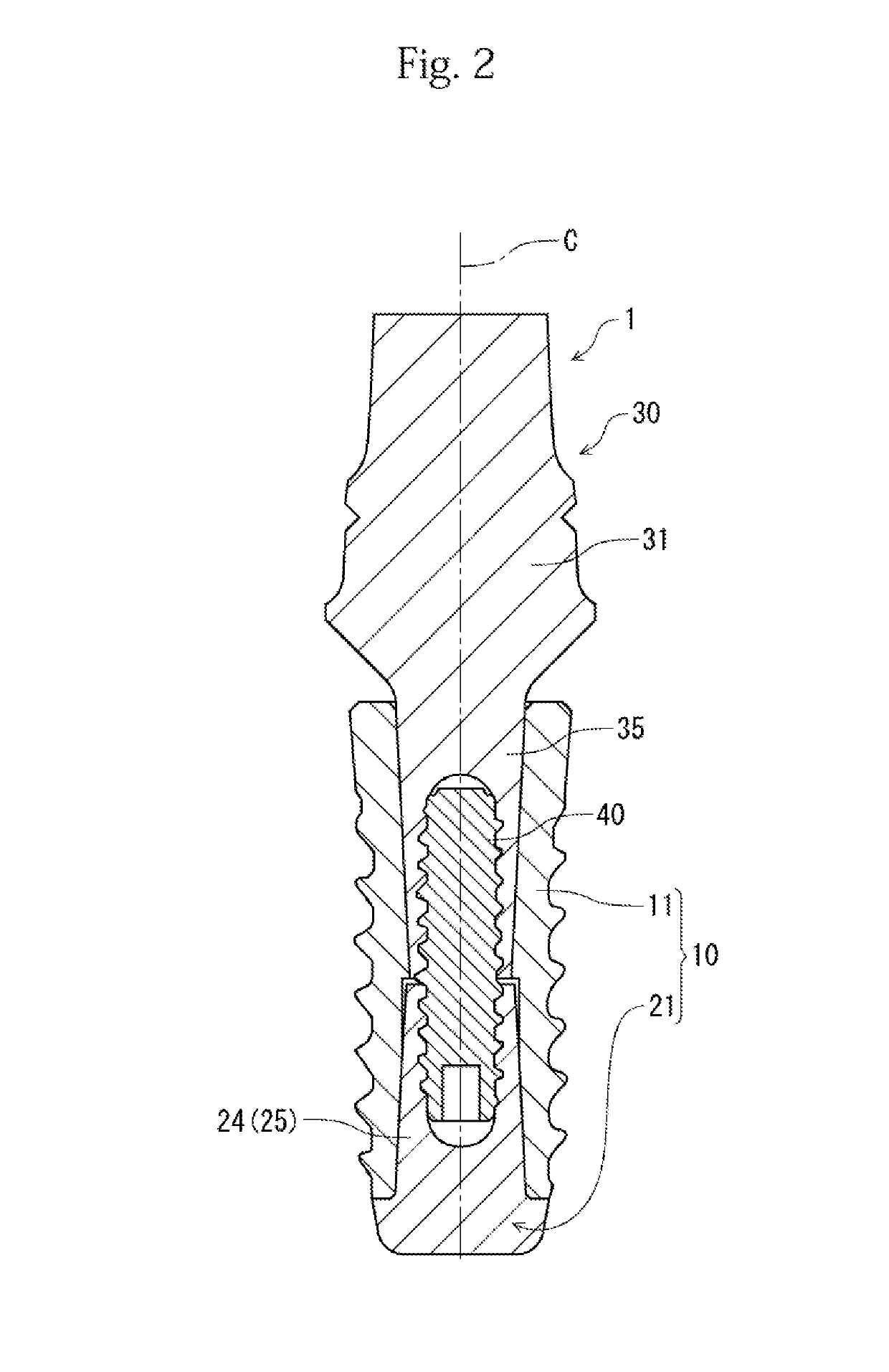 Fixture and implant