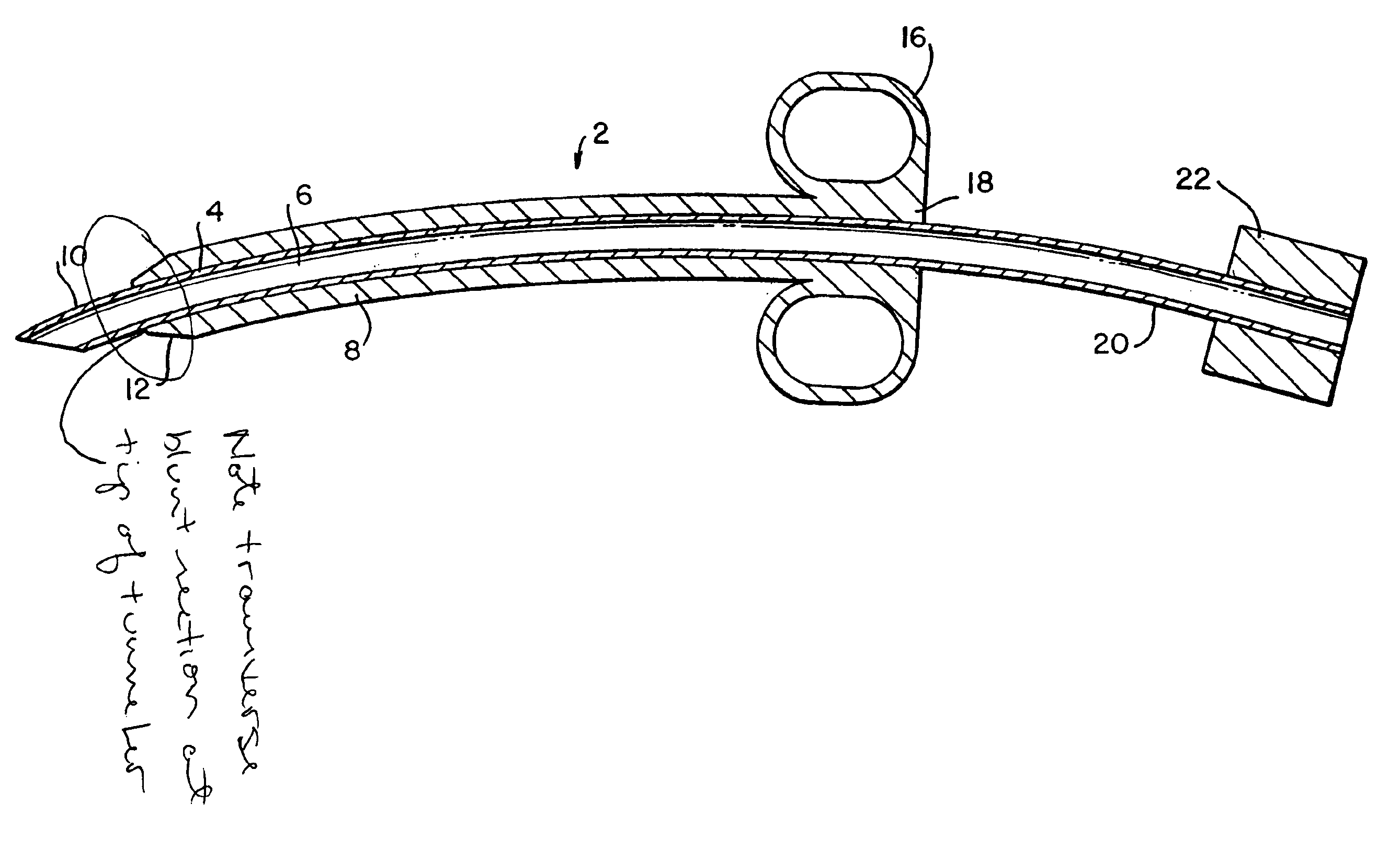 Tunneler-needle combination for tunneled catheter placement