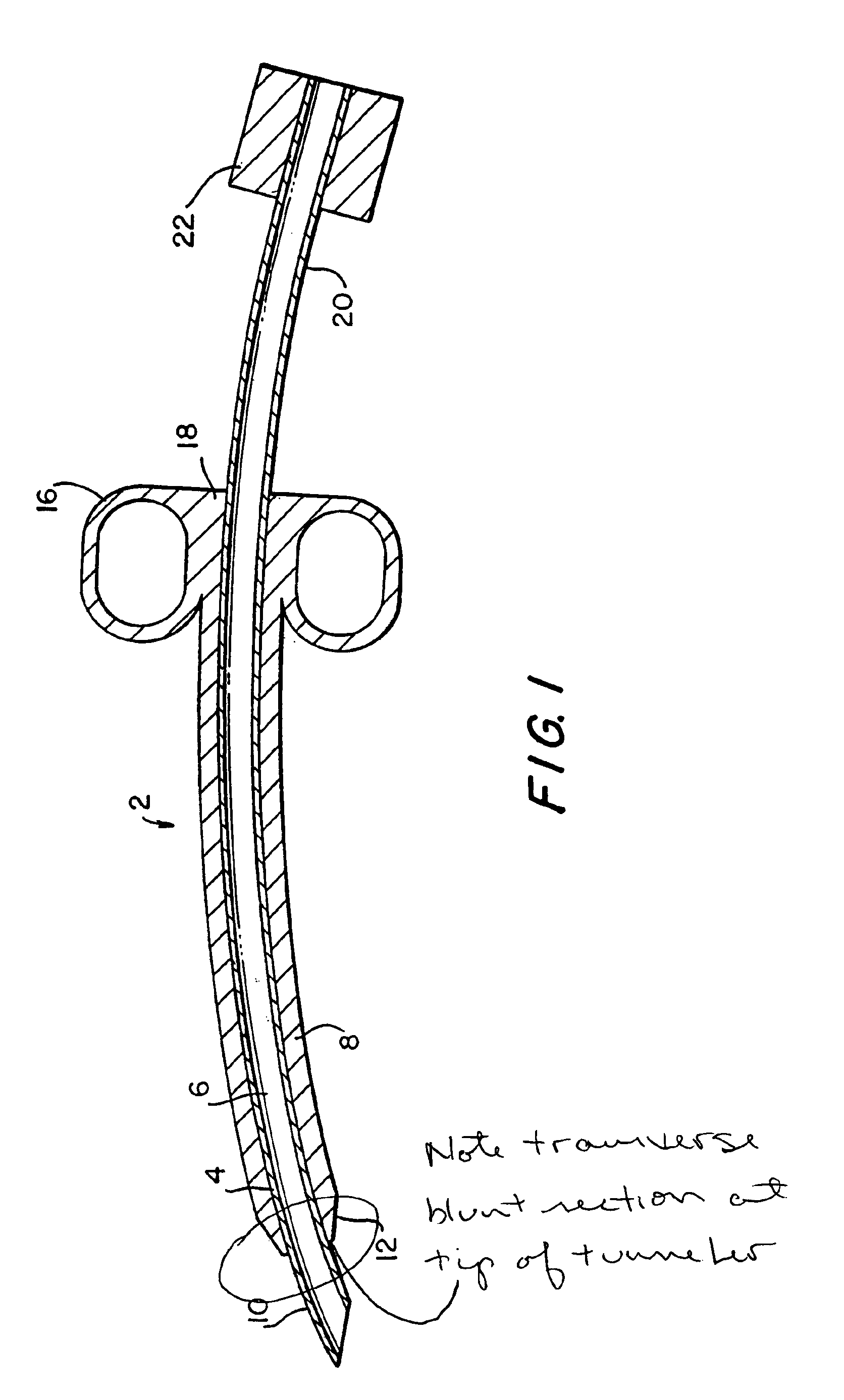 Tunneler-needle combination for tunneled catheter placement