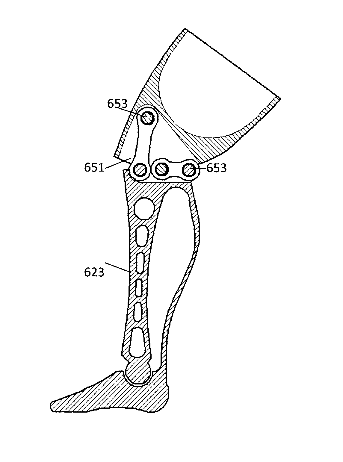 Prosthetic limb