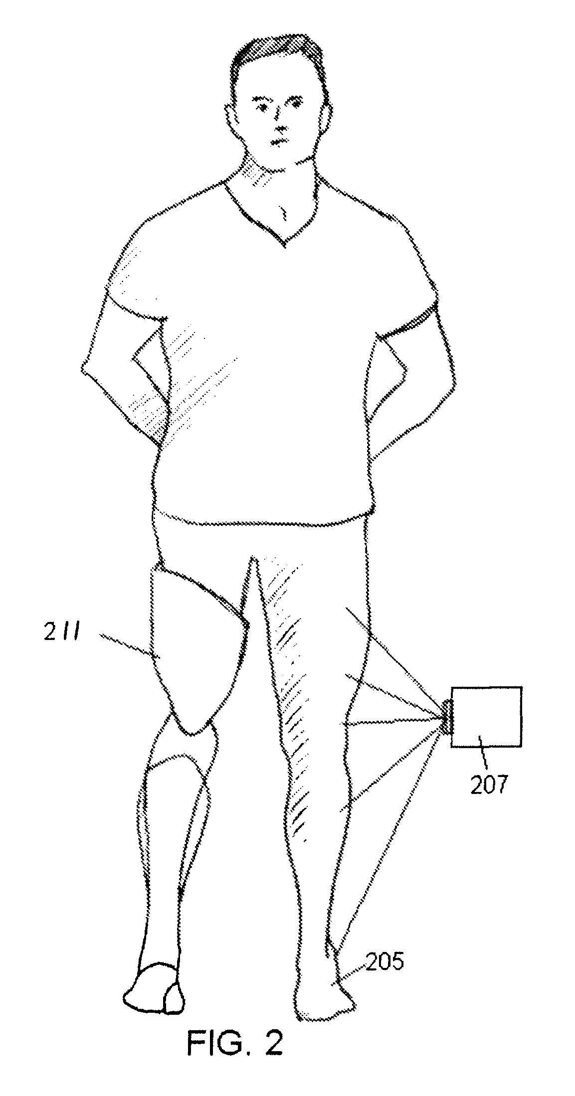 Prosthetic limb