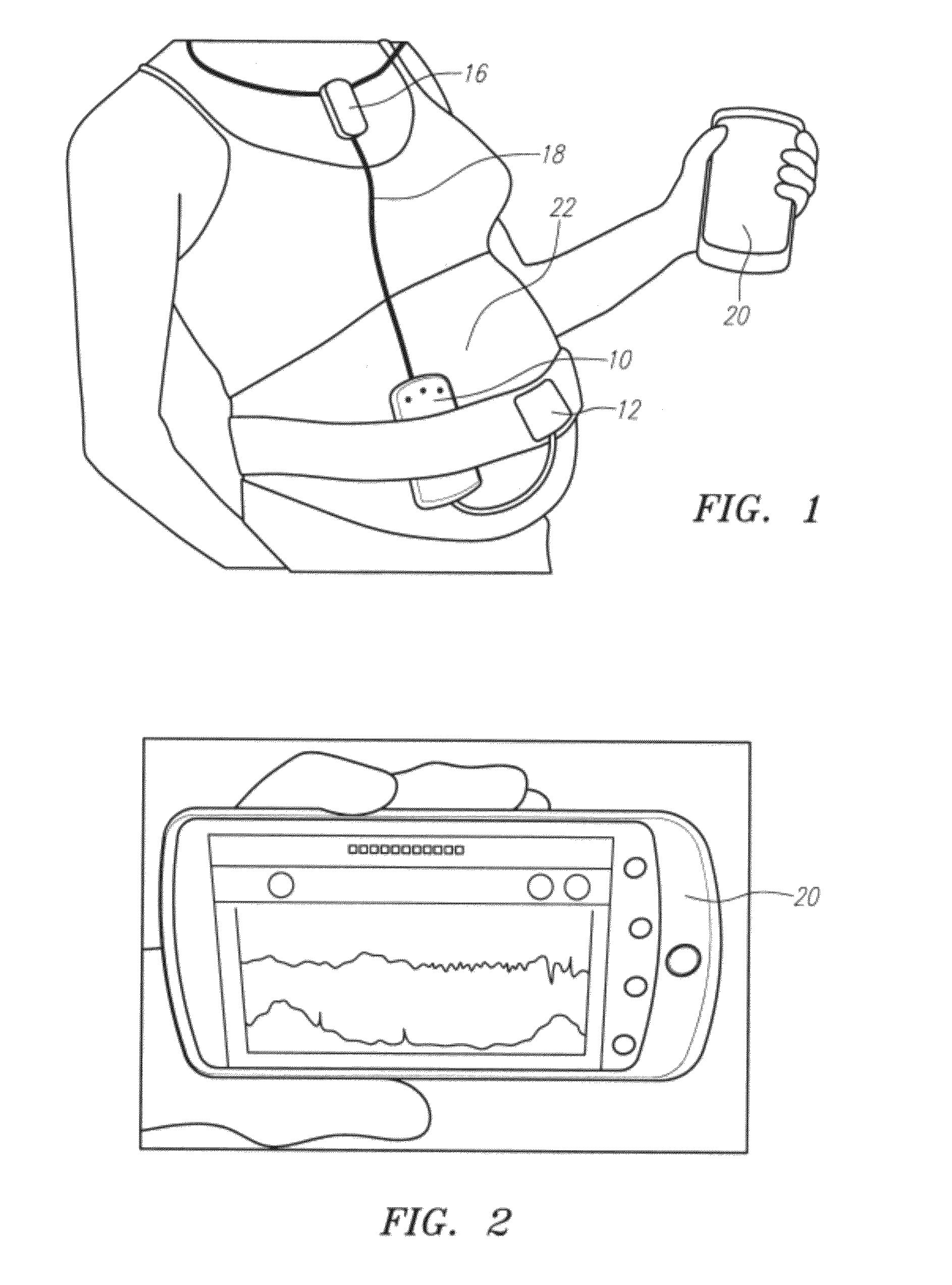 Wireless fetal monitoring system