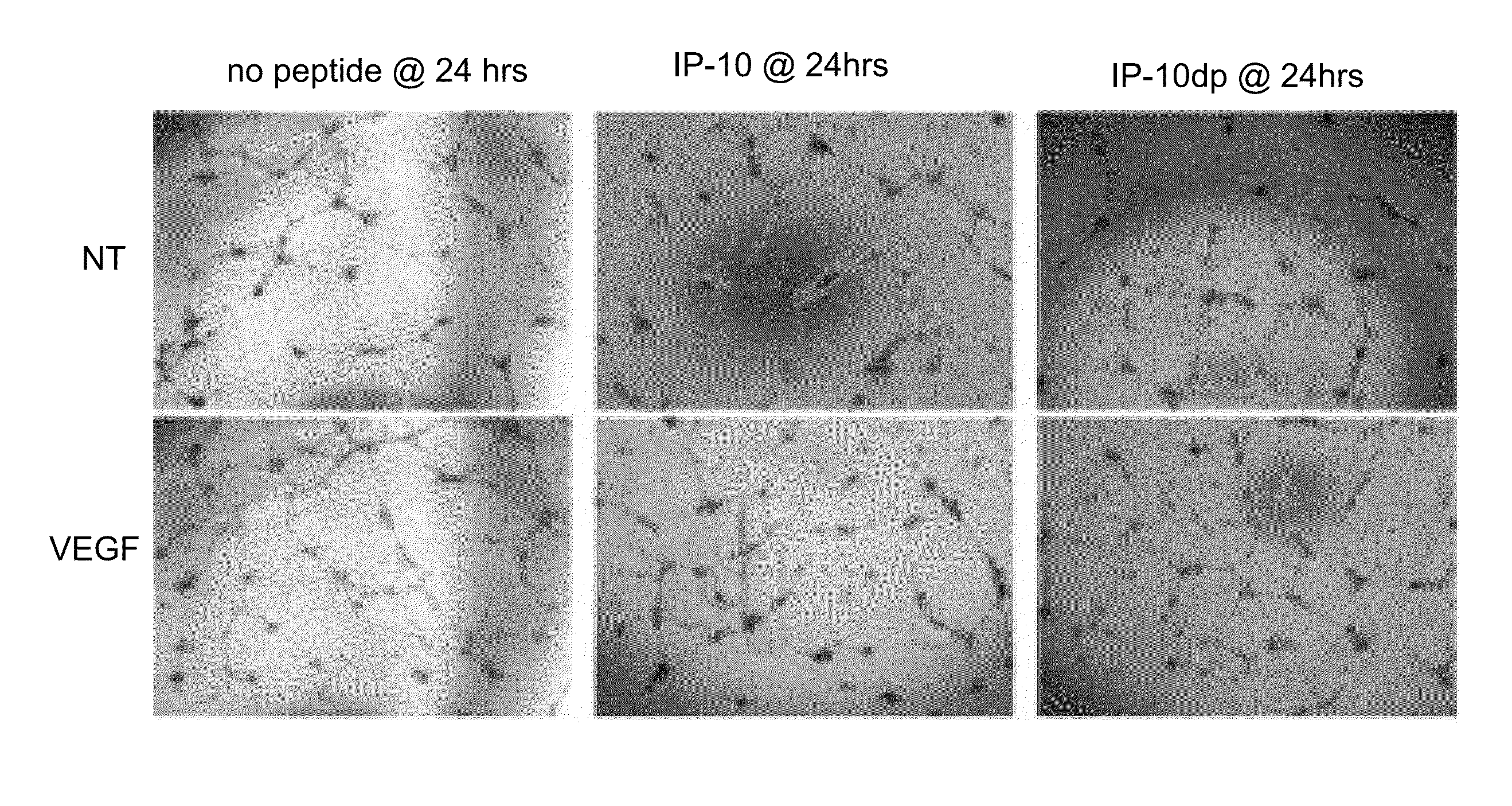 Chemokine derived peptides and uses for chronic wound and angiogenesis inhibition treatments