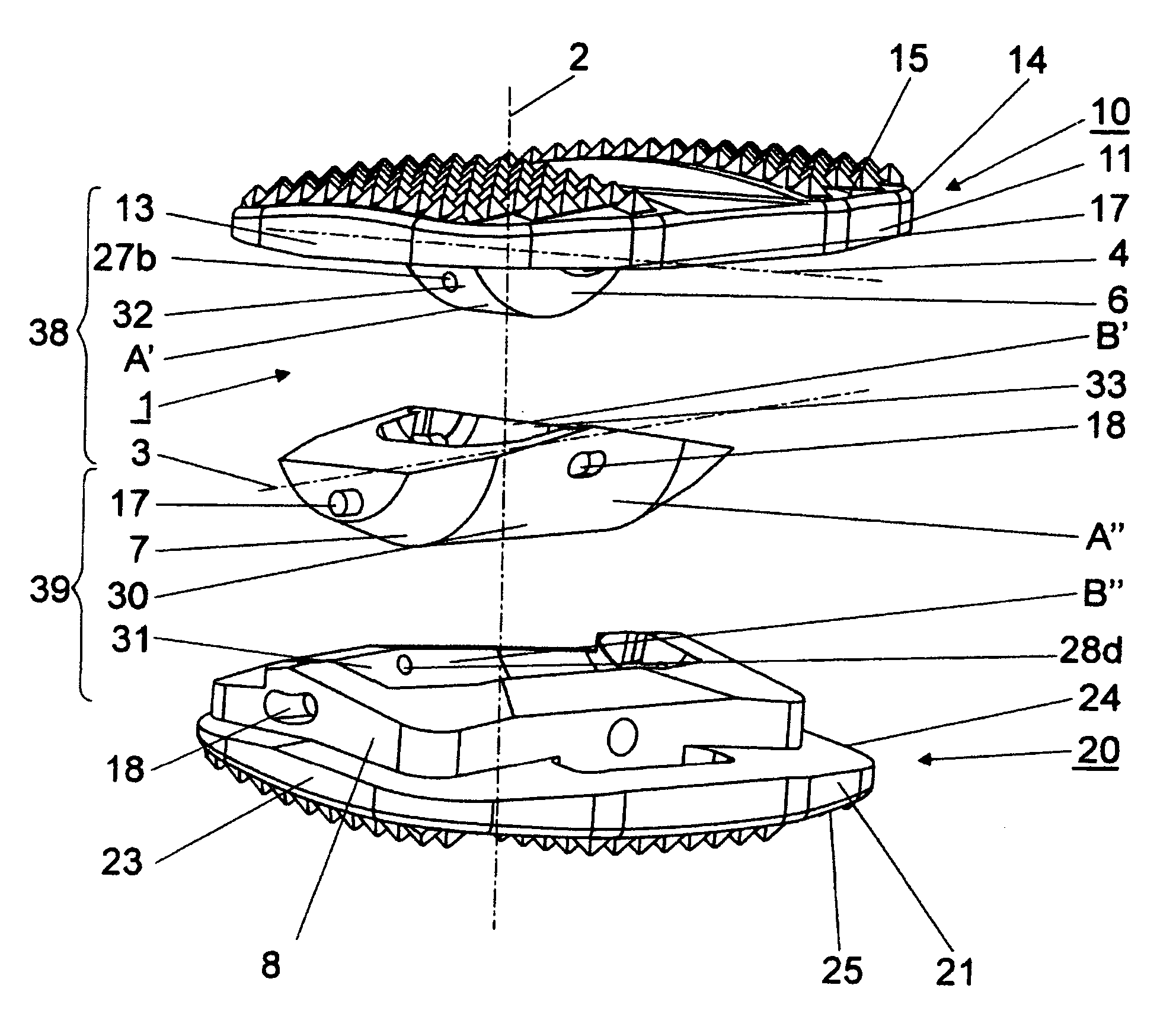 Articulated endoprosthesis