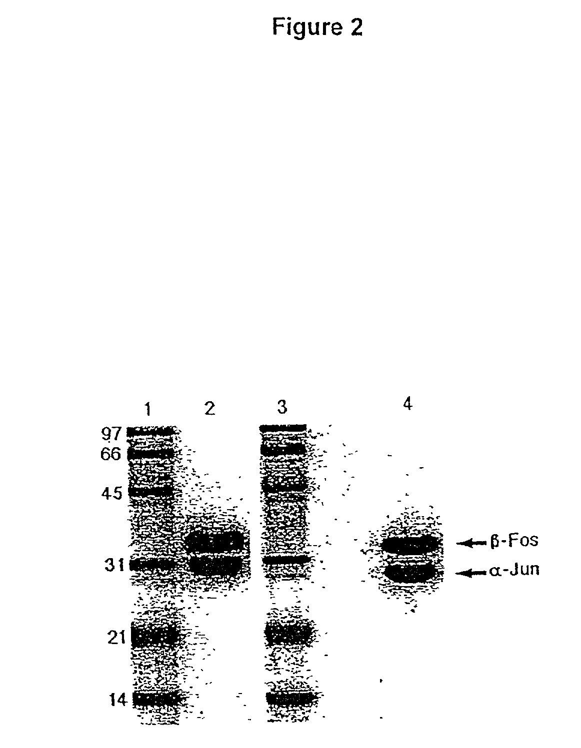 Soluble T cell receptor