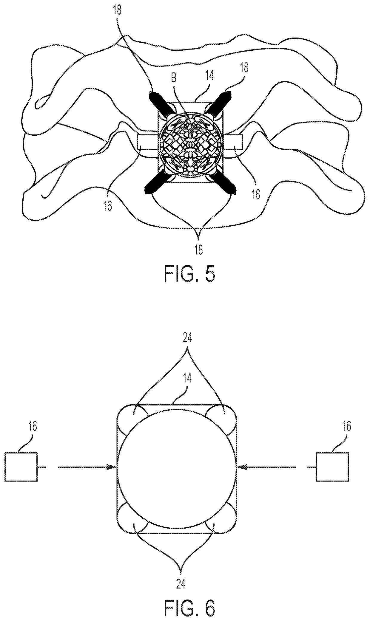 Cloward-style cervical mesh cage with lateral stabilizers