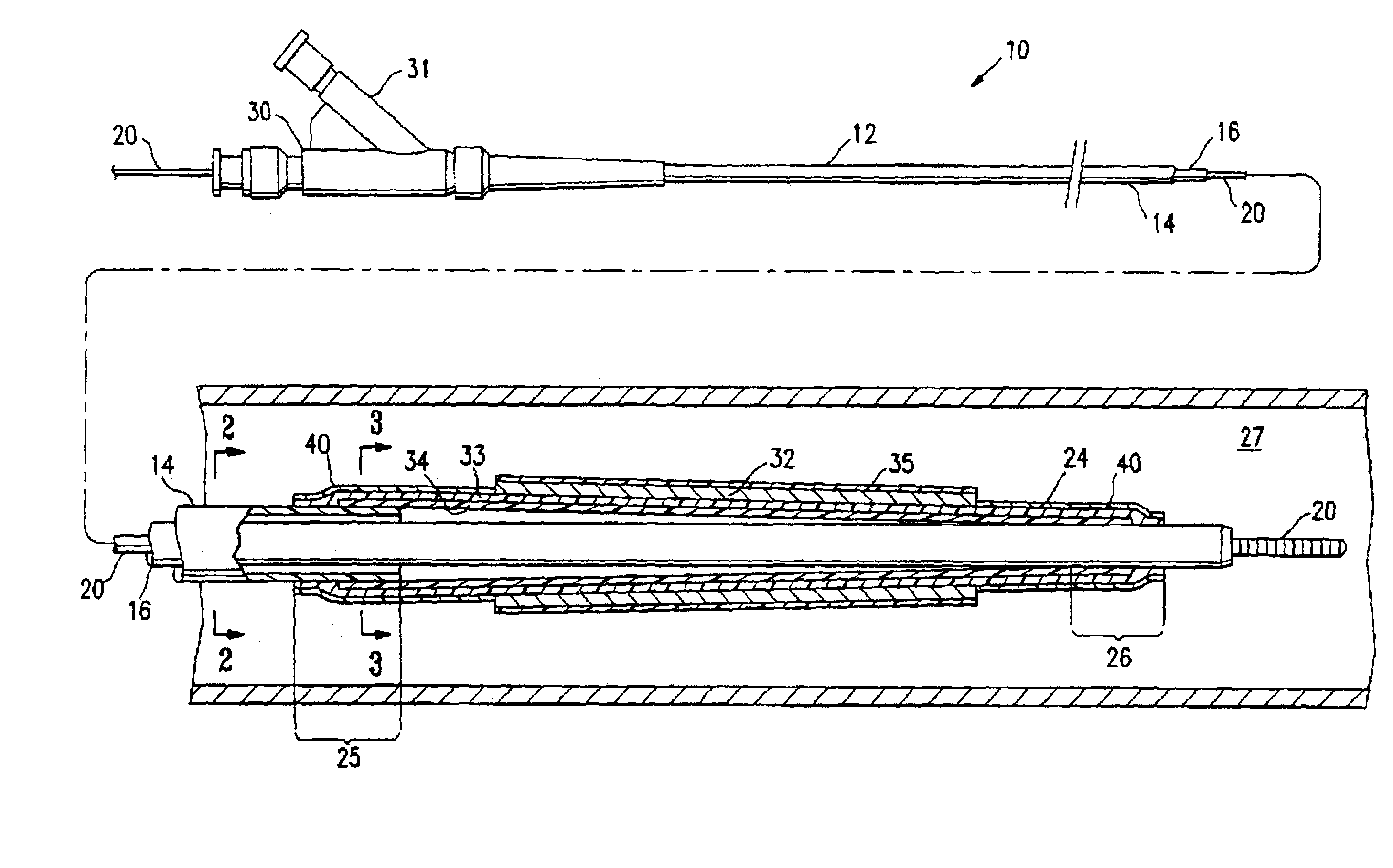 Catheter balloon having a lubricious coating