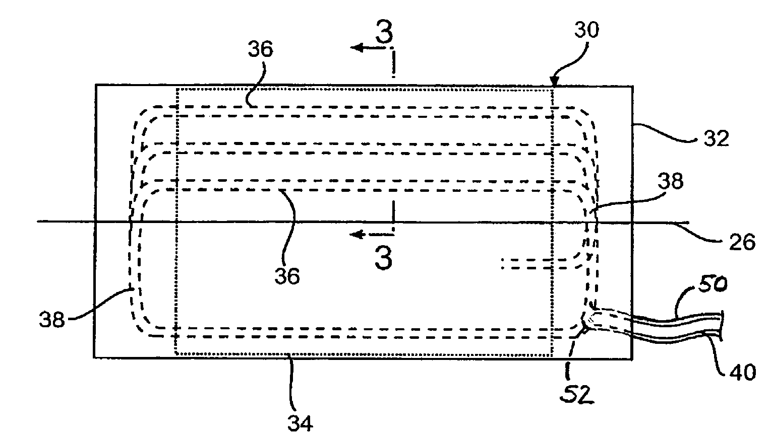 Electric motor and generator component having a plurality of windings made from a plurality of individually conductive wires