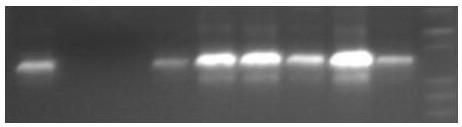 Construction method and application of axonal Charcot-Marie-Tooth drosophila model