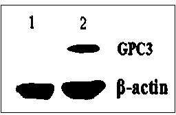 Dendritic cell tumor vaccine and preparation method and application thereof