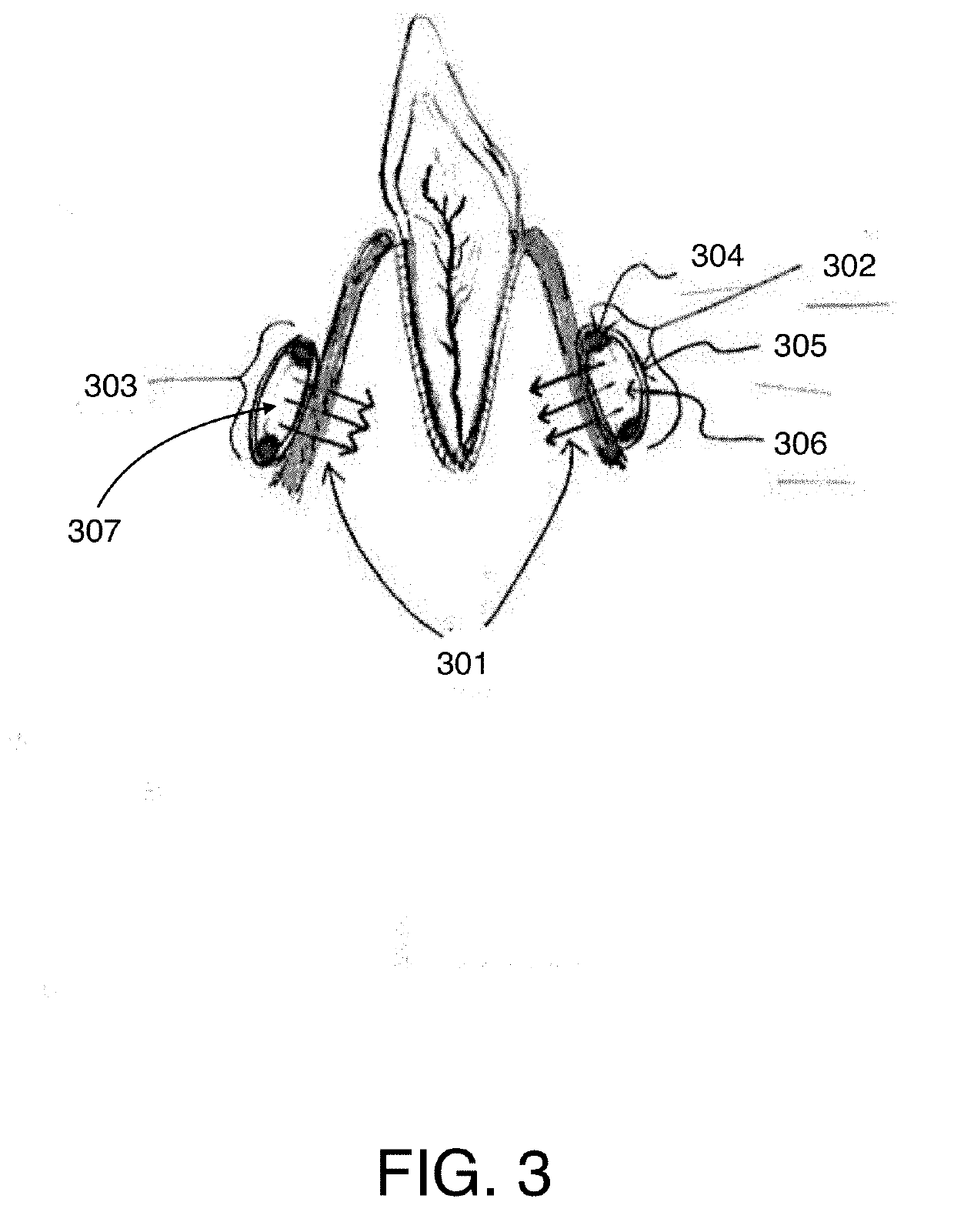 Recirculating Anesthetic Cooling Apparatus and Method