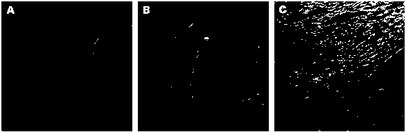 Method for discriminating liver cancer differentiation grades by using multiphoton imaging technology