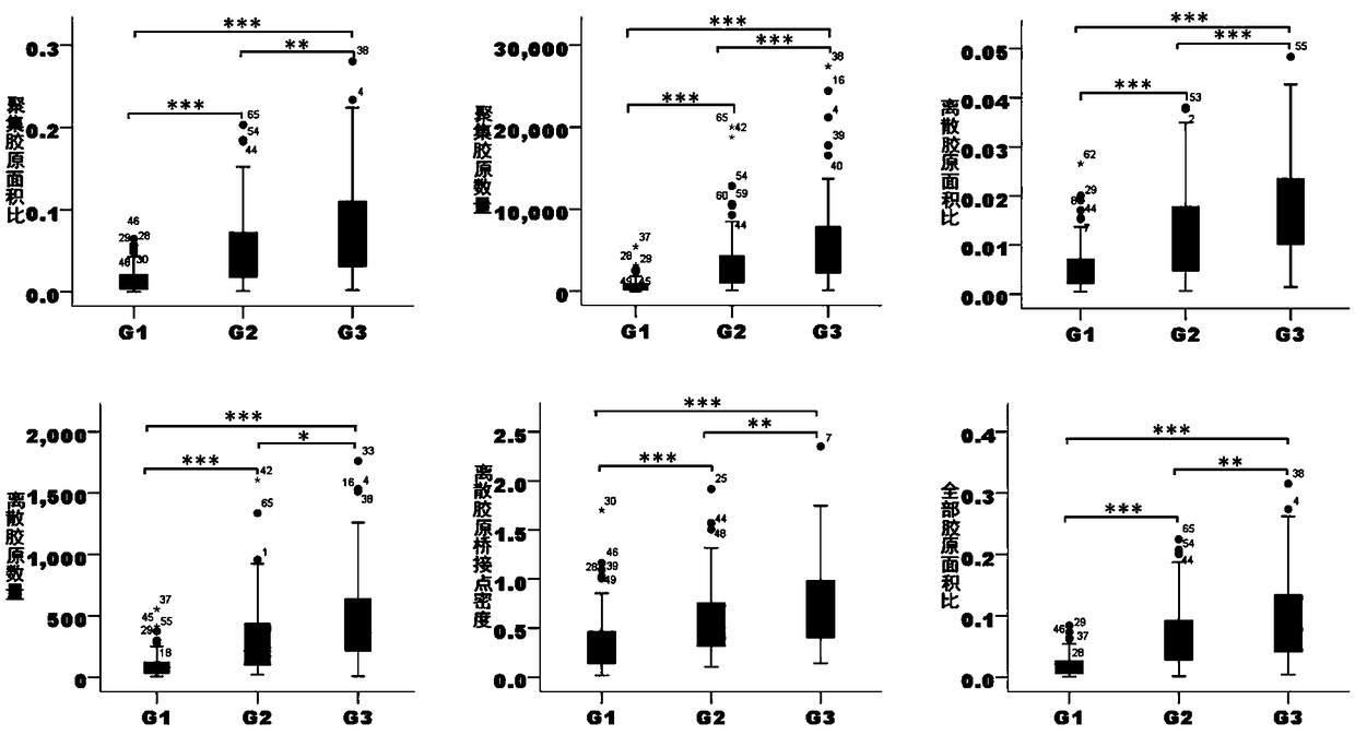 Method for discriminating liver cancer differentiation grades by using multiphoton imaging technology