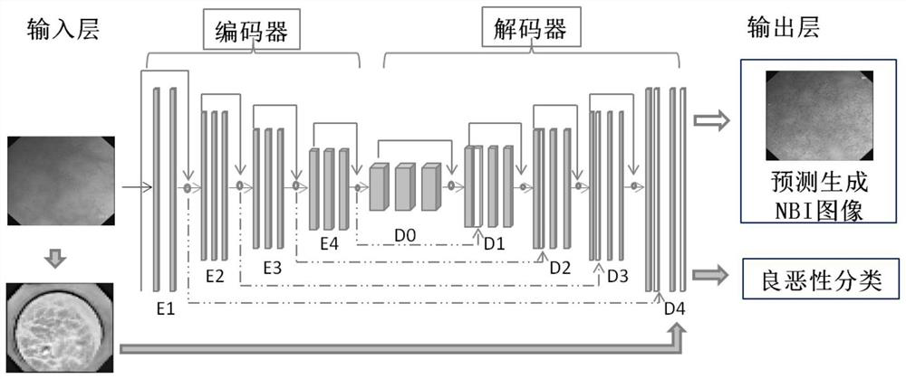 Convolutional neural network model for predicting and generating NBI image according to endoscope white light image and construction method and application of convolutional neural network model