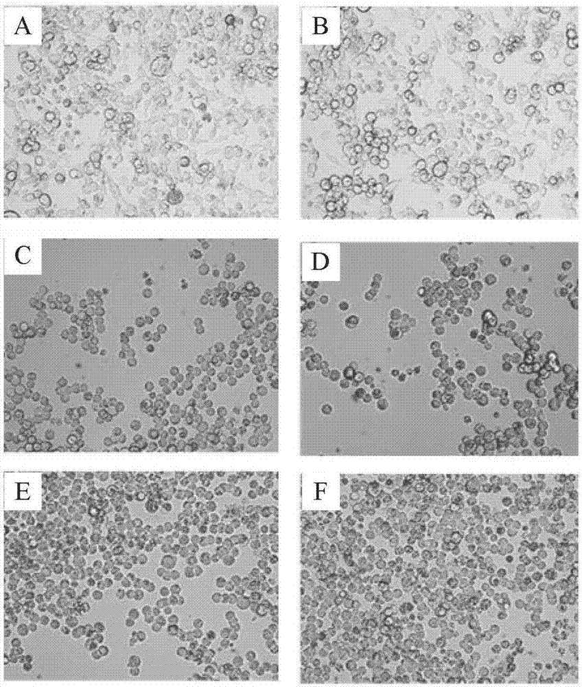 Targeted rat phospholipase Cgamma2 interfering recombinant adenovirus, and construction method and application thereof