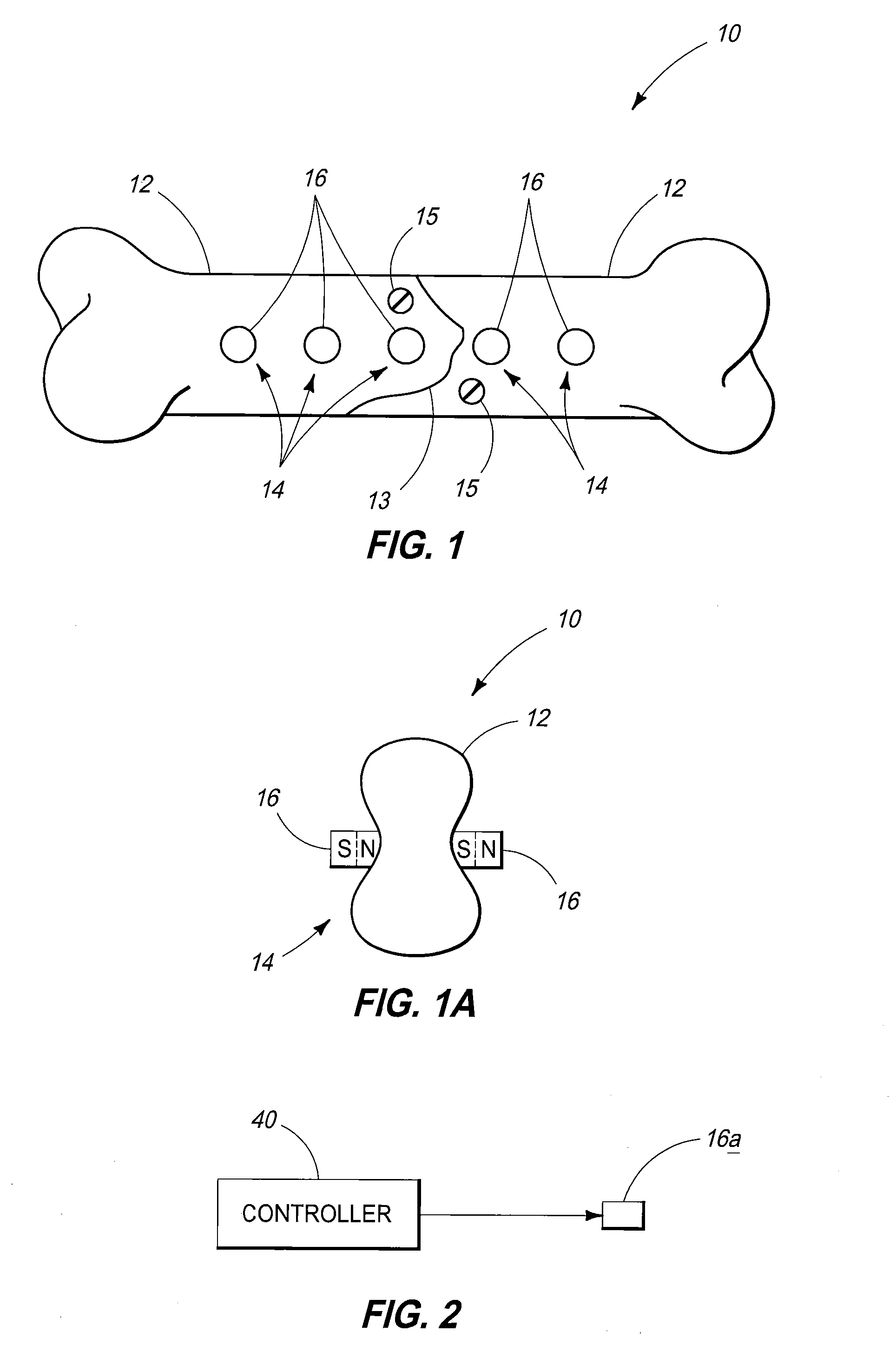 Fractured Bone Treatment Methods And Fractured Bone Treatment Assemblies