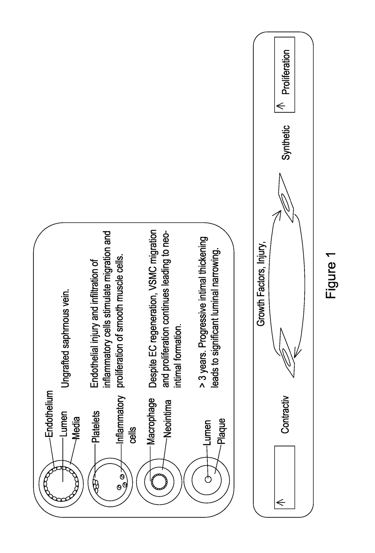 Materials and methods for the treatment of vascular disease