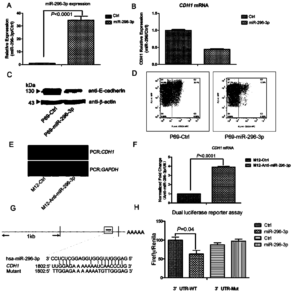 Application of miR-296-3p to preparation of kit for diagnosing prostate cancer generation or migration