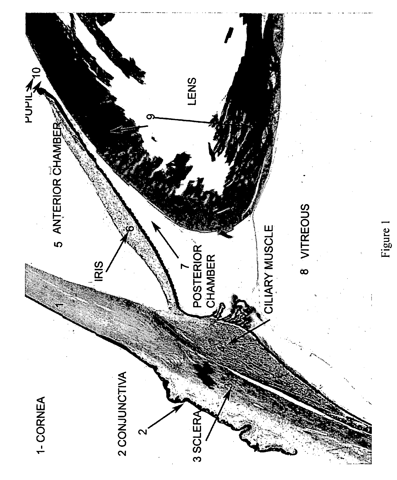 Method and system for effecting changes in pigmented tissue