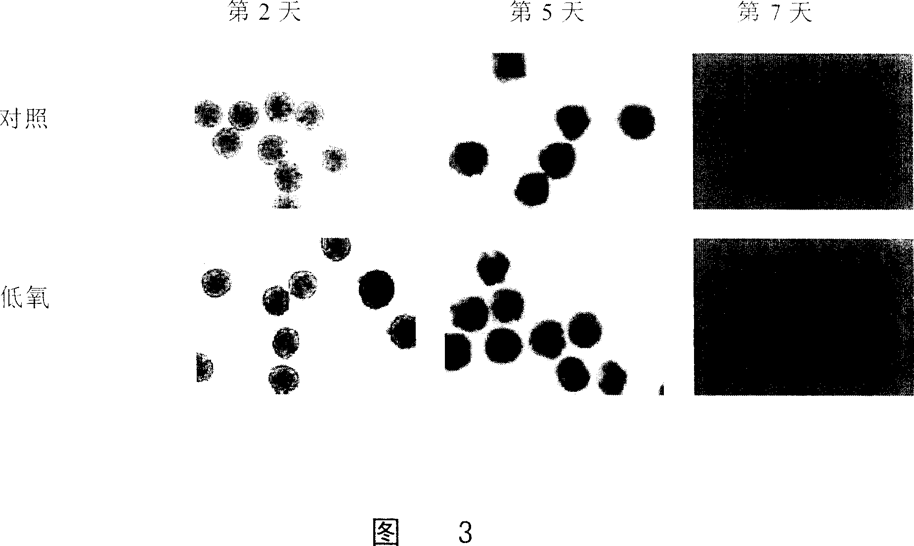 Method for improving embryonic stem cell to differentiate to cardiac muscle cell